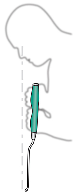 Offset Long Curette